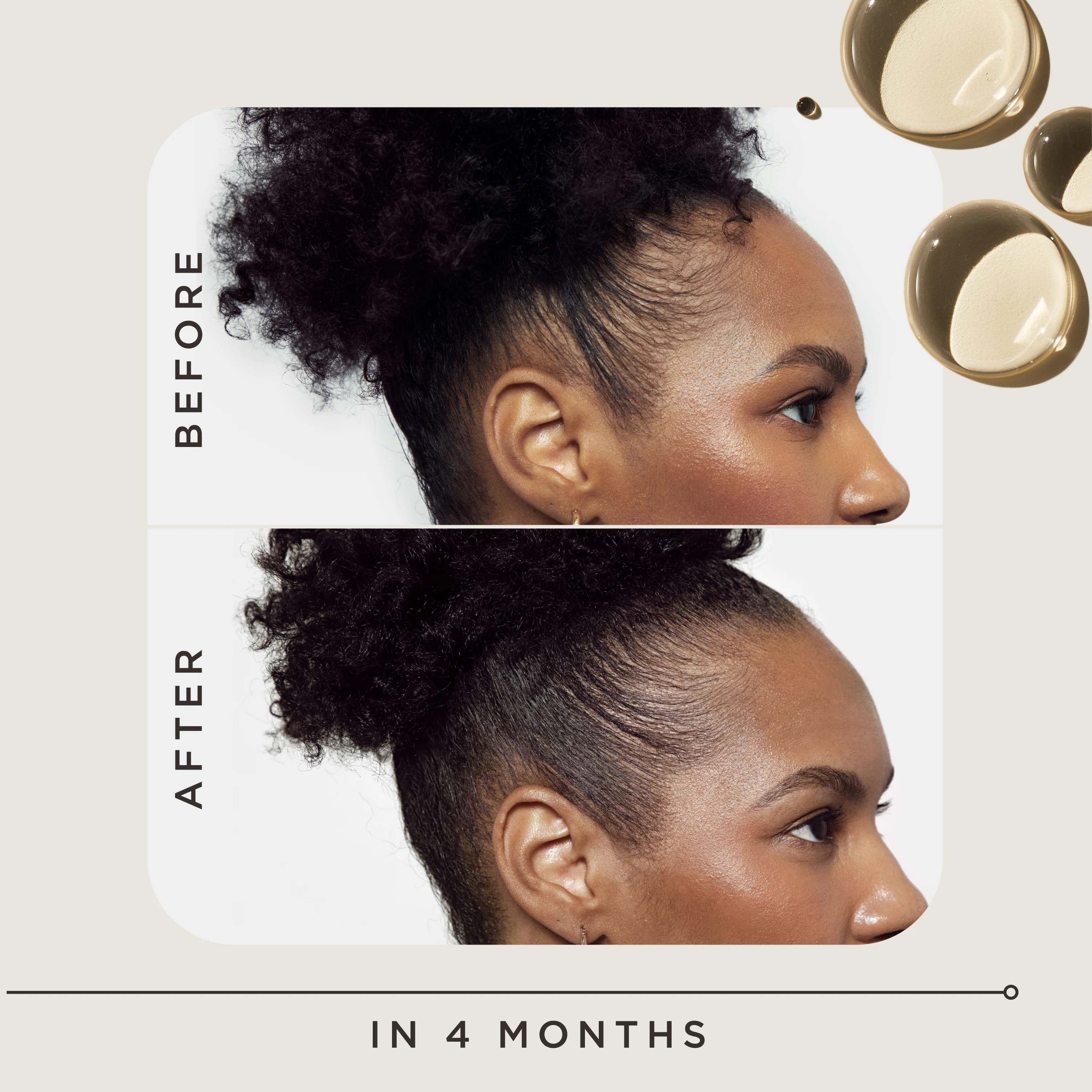 Goddess Strength Hair Regrowth Treatment with 2% Minoxidil - Image 4